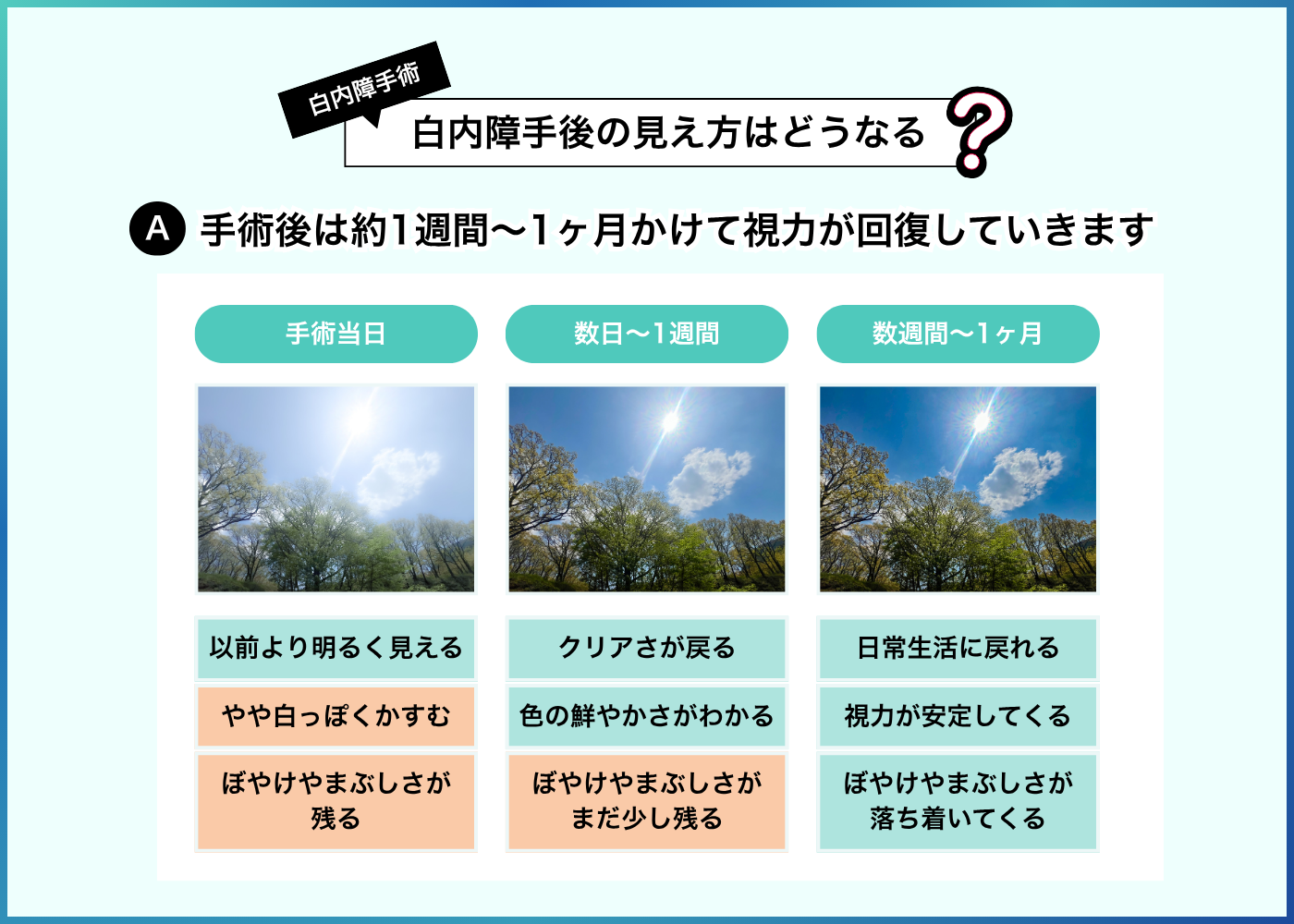 白内障手術後の見え方