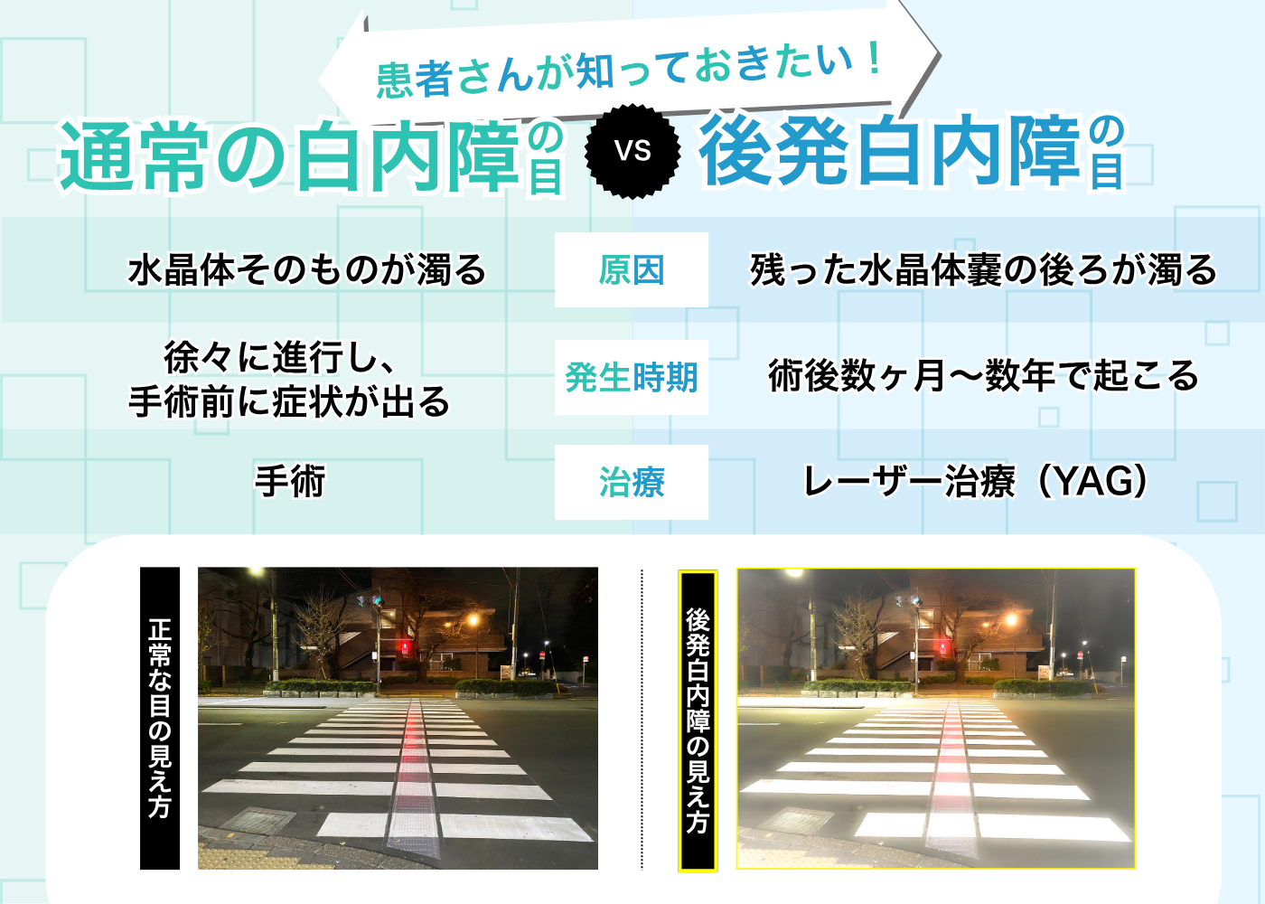 術後の生活注意事項